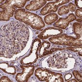 Anti-AK3 antibody produced in rabbit Prestige Antibodies® Powered by Atlas Antibodies, affinity isolated antibody, buffered aqueous glycerol solution