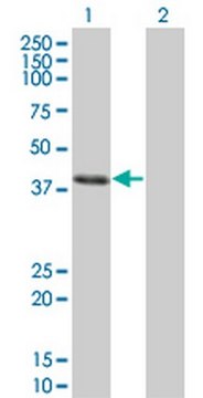 Anti-CLN3 Mouse mAb (1G10) liquid, clone 1G10, Calbiochem&#174;