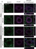 Anti-K+/Cl- Cotransporter (KCC2) Antibody Upstate®, from rabbit