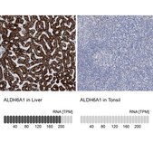 Anti-ALDH6A1 antibody produced in rabbit Prestige Antibodies® Powered by Atlas Antibodies, affinity isolated antibody, buffered aqueous glycerol solution, ab2
