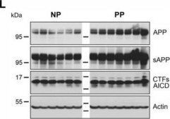 Anti-Actin Antibody, smooth muscle γ &amp; α actin, clone CGA7 ascites fluid, clone CGA7, Chemicon®