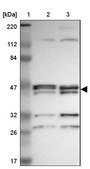 Anti-PARVA antibody produced in rabbit Prestige Antibodies® Powered by Atlas Antibodies, affinity isolated antibody, buffered aqueous glycerol solution