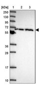 Anti-CCT6A antibody produced in rabbit Prestige Antibodies® Powered by Atlas Antibodies, affinity isolated antibody, buffered aqueous glycerol solution