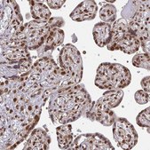Anti-XPO1 antibody produced in rabbit Prestige Antibodies® Powered by Atlas Antibodies, affinity isolated antibody, buffered aqueous glycerol solution