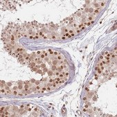 Anti-NUP50 antibody produced in rabbit Prestige Antibodies® Powered by Atlas Antibodies, affinity isolated antibody, buffered aqueous glycerol solution