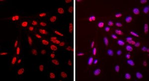AT-3 Mouse Mammary Carcinoma Cell Line AT-3 mouse mammary tumor cell line may be used to develop mouse models for mammary cancer studies.