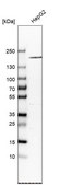 Anti-A2M antibody produced in rabbit Prestige Antibodies® Powered by Atlas Antibodies, affinity isolated antibody, buffered aqueous glycerol solution
