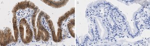 Anti-Angiopoietin-1 Antibody, clone 2F9 ZooMAb® Rabbit Monoclonal recombinant, expressed in HEK 293 cells