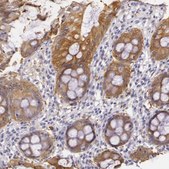 Anti-CKB antibody produced in rabbit Prestige Antibodies® Powered by Atlas Antibodies, affinity isolated antibody, buffered aqueous glycerol solution