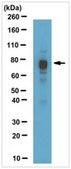 ChIPAb+ MeCP2 - ChIP Validated Antibody and Primer Set from chicken, purified by affinity chromatography