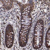 Anti-SOD2 antibody produced in rabbit Prestige Antibodies® Powered by Atlas Antibodies, affinity isolated antibody, buffered aqueous glycerol solution