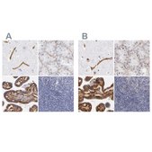 Anti-LAMC1 antibody produced in rabbit Ab2, Prestige Antibodies® Powered by Atlas Antibodies, affinity isolated antibody, buffered aqueous glycerol solution