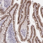 Anti-HNF4G antibody produced in rabbit Prestige Antibodies® Powered by Atlas Antibodies, affinity isolated antibody, buffered aqueous glycerol solution