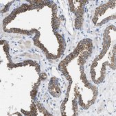 Anti-PDLIM5 antibody produced in rabbit Prestige Antibodies® Powered by Atlas Antibodies, affinity isolated antibody, buffered aqueous glycerol solution