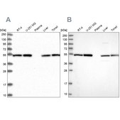 Anti-DCTN2 antibody produced in rabbit Prestige Antibodies® Powered by Atlas Antibodies, affinity isolated antibody, buffered aqueous glycerol solution