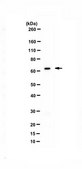 Anti-nSR100 (SRRM4) from rabbit