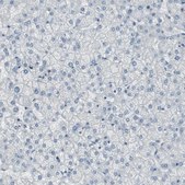 Anti-DMPK antibody produced in rabbit Ab1, Prestige Antibodies® Powered by Atlas Antibodies, affinity isolated antibody, buffered aqueous glycerol solution