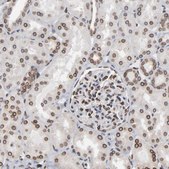 Anti-SYNE2 antibody produced in rabbit Prestige Antibodies® Powered by Atlas Antibodies, affinity isolated antibody, buffered aqueous glycerol solution