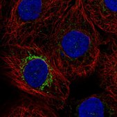 Anti-MPP2 antibody produced in rabbit Prestige Antibodies® Powered by Atlas Antibodies, affinity isolated antibody, buffered aqueous glycerol solution