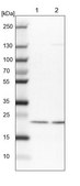 Anti-COMMD2 antibody produced in rabbit Prestige Antibodies® Powered by Atlas Antibodies, affinity isolated antibody, buffered aqueous glycerol solution