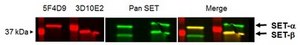 Anti-SET-alpha, clone 5F4D9 clone 5F4D9, from mouse
