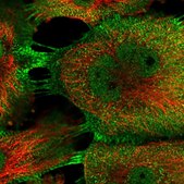 Anti-PDLIM5 antibody produced in rabbit Prestige Antibodies® Powered by Atlas Antibodies, affinity isolated antibody, buffered aqueous glycerol solution