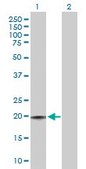 Anti-CD3D antibody produced in rabbit purified immunoglobulin, buffered aqueous solution