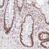 Anti-SRSF10 antibody produced in rabbit Prestige Antibodies® Powered by Atlas Antibodies, affinity isolated antibody, buffered aqueous glycerol solution