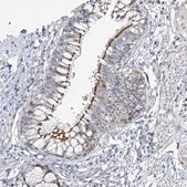 Anti-CEP164 antibody produced in rabbit Prestige Antibodies® Powered by Atlas Antibodies, affinity isolated antibody, buffered aqueous glycerol solution