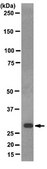 Anti-Replication Protein A Antibody, clone RPA34-20 clone RPA34-20, from mouse