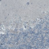 Monoclonal Anti-SLC27A5 antibody produced in mouse Prestige Antibodies® Powered by Atlas Antibodies, clone CL0215, purified immunoglobulin, buffered aqueous glycerol solution