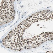Anti-FKBP4 antibody produced in rabbit Prestige Antibodies® Powered by Atlas Antibodies, affinity isolated antibody, buffered aqueous glycerol solution