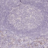Anti-ACVR1B antibody produced in rabbit Prestige Antibodies® Powered by Atlas Antibodies, affinity isolated antibody, buffered aqueous glycerol solution
