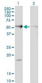 Monoclonal Anti-RAD23B, (C-terminal) antibody produced in mouse clone 3H7, purified immunoglobulin, buffered aqueous solution