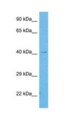 Anti-SLC10A1 affinity isolated antibody