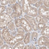 Anti-FASTK antibody produced in rabbit Prestige Antibodies® Powered by Atlas Antibodies, affinity isolated antibody, buffered aqueous glycerol solution