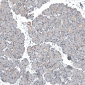 Anti-KNSTRN antibody produced in rabbit Prestige Antibodies® Powered by Atlas Antibodies, affinity isolated antibody, buffered aqueous glycerol solution