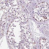 Anti-AKR1E2 antibody produced in rabbit Prestige Antibodies® Powered by Atlas Antibodies, affinity isolated antibody, buffered aqueous glycerol solution