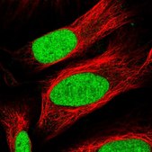 Anti-TAF13 antibody produced in rabbit Prestige Antibodies® Powered by Atlas Antibodies, affinity isolated antibody, buffered aqueous glycerol solution