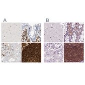 Anti-ARHGAP25 antibody produced in rabbit Prestige Antibodies® Powered by Atlas Antibodies, affinity isolated antibody, buffered aqueous glycerol solution