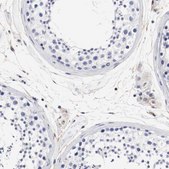 Anti-IFITM1 antibody produced in rabbit Prestige Antibodies® Powered by Atlas Antibodies, affinity isolated antibody, buffered aqueous glycerol solution