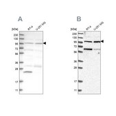 Anti-KIAA0753 antibody produced in rabbit Prestige Antibodies® Powered by Atlas Antibodies, affinity isolated antibody, buffered aqueous glycerol solution, Ab2