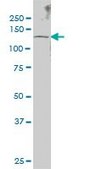 Monoclonal Anti-SENP6 antibody produced in mouse clone 4B7, purified immunoglobulin, buffered aqueous solution