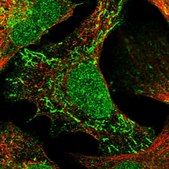Anti-TNRC18 antibody produced in rabbit Prestige Antibodies® Powered by Atlas Antibodies, affinity isolated antibody, buffered aqueous glycerol solution