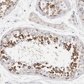 Anti-STK31 antibody produced in rabbit Prestige Antibodies® Powered by Atlas Antibodies, affinity isolated antibody, buffered aqueous glycerol solution