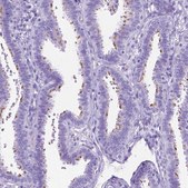 Anti-DNAH2 antibody produced in rabbit Prestige Antibodies® Powered by Atlas Antibodies, affinity isolated antibody, buffered aqueous glycerol solution