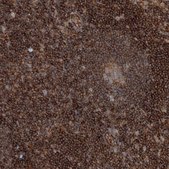 Anti-WDR37 antibody produced in rabbit Prestige Antibodies® Powered by Atlas Antibodies, affinity isolated antibody, buffered aqueous glycerol solution