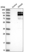Anti-SPAG5 antibody produced in rabbit Prestige Antibodies® Powered by Atlas Antibodies, affinity isolated antibody, buffered aqueous glycerol solution, Ab1