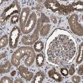 Anti-FZD6 antibody produced in rabbit Prestige Antibodies® Powered by Atlas Antibodies, affinity isolated antibody, buffered aqueous glycerol solution