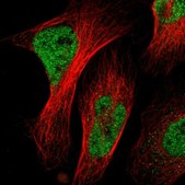 Anti-NACC1 antibody produced in rabbit Prestige Antibodies® Powered by Atlas Antibodies, affinity isolated antibody, buffered aqueous glycerol solution